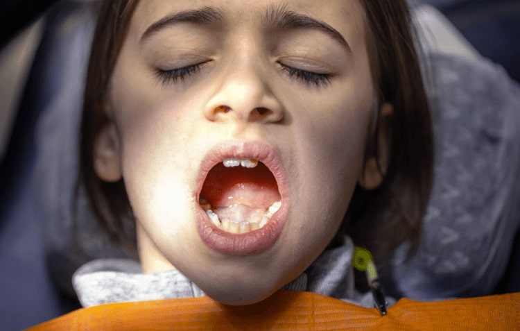 Dental visits for childs