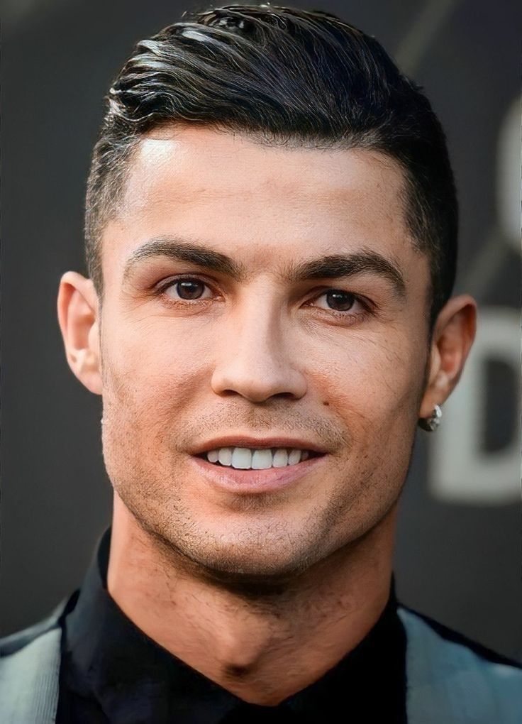 Cristiano Ronaldo after veneers