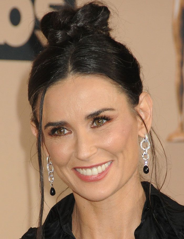Demi Moore after veneers