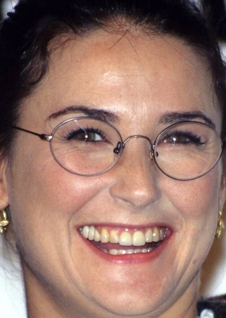 Demi Moore before veneers