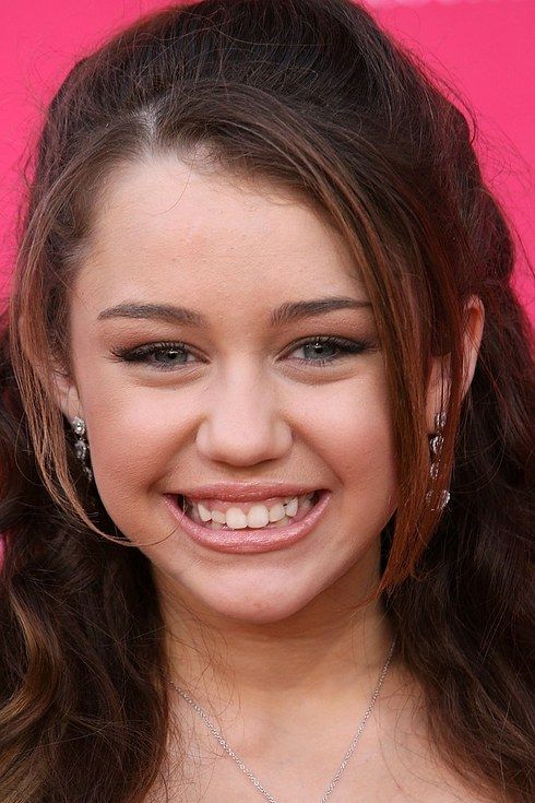 Miley Cyrus before dental veneers