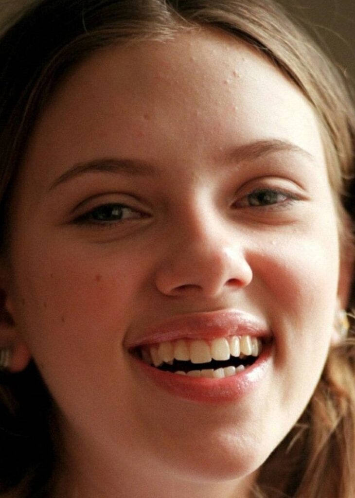 Scarlett Johansson before veneers