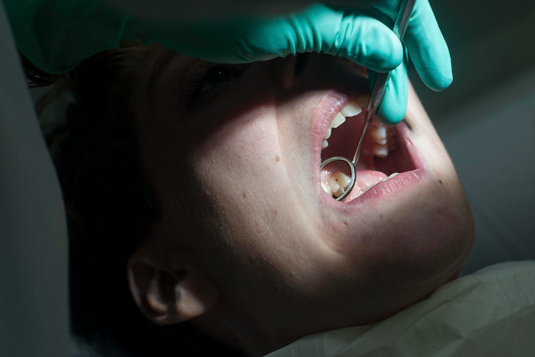 a patient getting her teeth checked by a dentist as dealing with a tooth extraction infection.