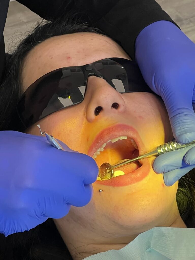 Dental Veneers North York