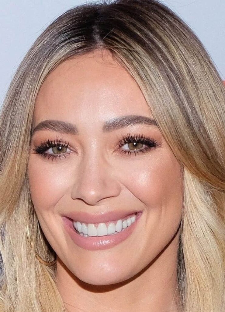 Hilary Duff after dental veneers