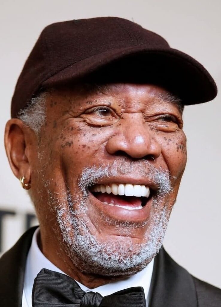 Morgan Freeman after dental veneers