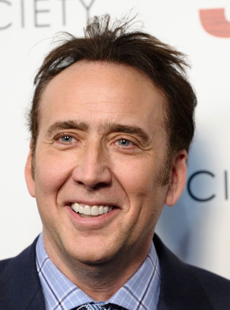 Nicolas Cage after veneers