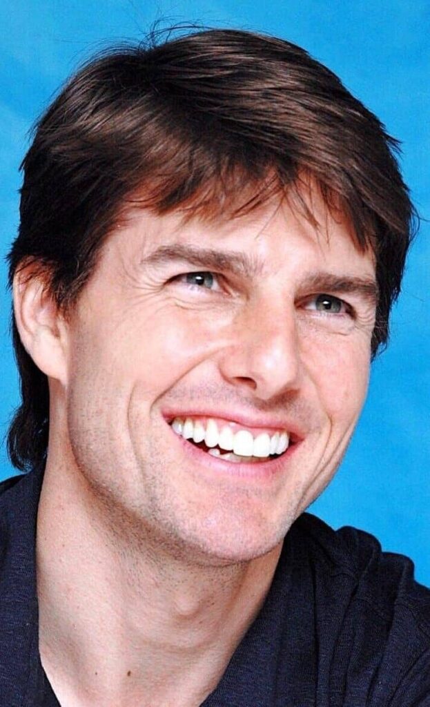 tom cruise after dental veneers