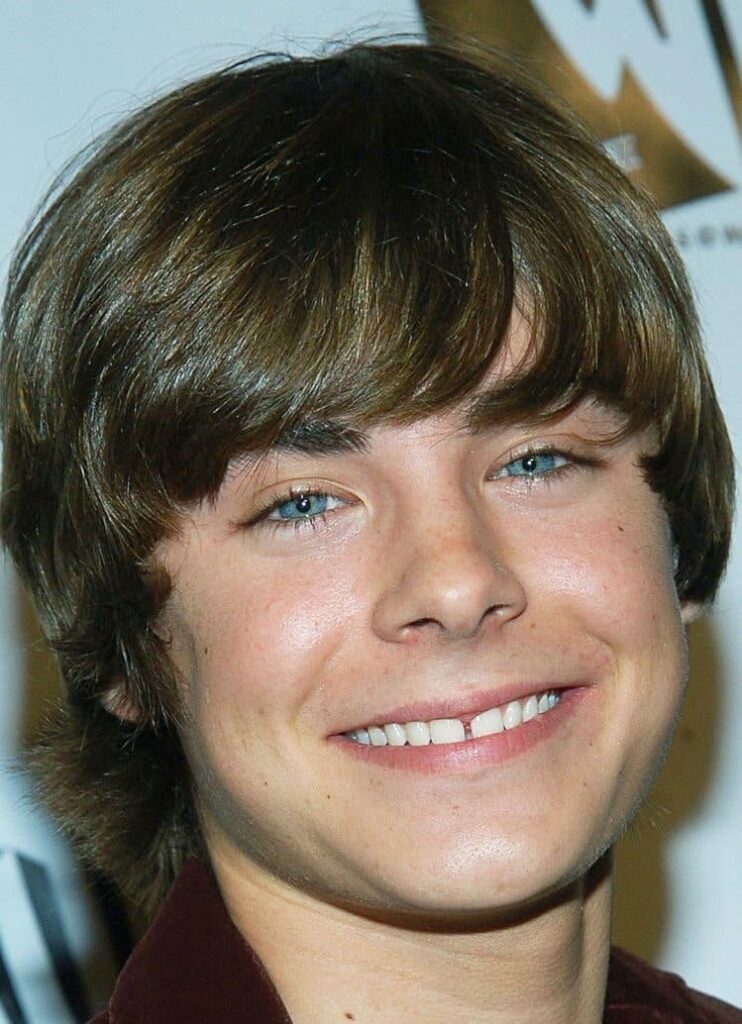 Zac Efron before dental veneers