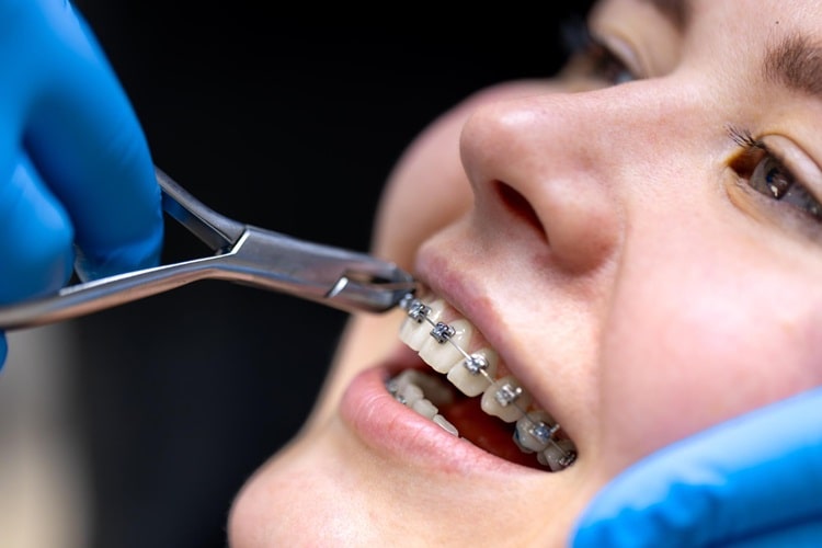 dentist working on patient's braces