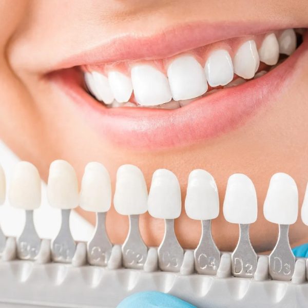 Preparation and Customization