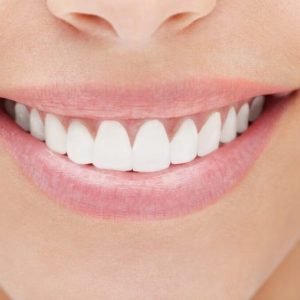 Installation and Aftercare